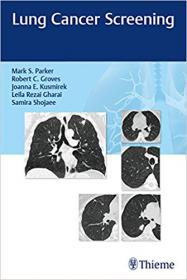 Lung Cancer Screening, 1st Edition