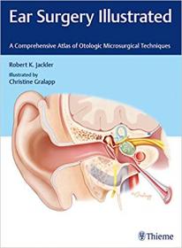 Ear Surgery Illustrated- A Comprehensive Atlas of Otologic Microsurgical Techniques