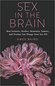 Sex in the Brain - How Seizures, Strokes, Dementia, Tumors, and Trauma Can Change Your Sex Life
