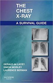 The Chest X-Ray - A Survival Guide - 1st Edition