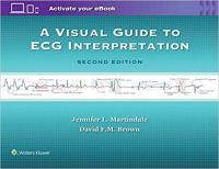 A Visual Guide to ECG Interpretation Second Edition (TRUE EPUB)
